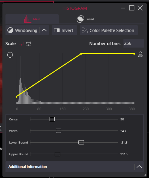MedDream Dicom Viewer Histogram