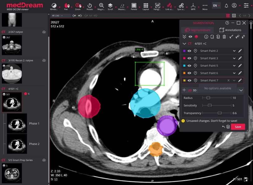 MedDream Web DICOM Viewer Segmentation Tools