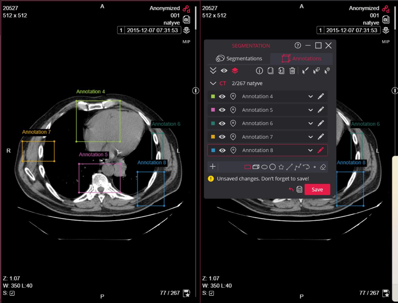 MedDream web dicom viewer Segmentation Annotation menu