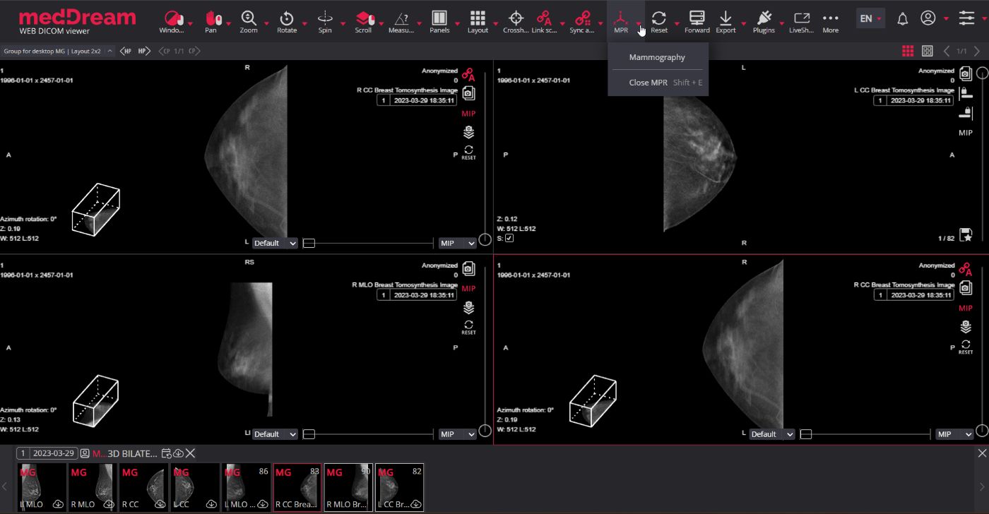 MedDream Dicom Viewer MPR Mammograpthy Web