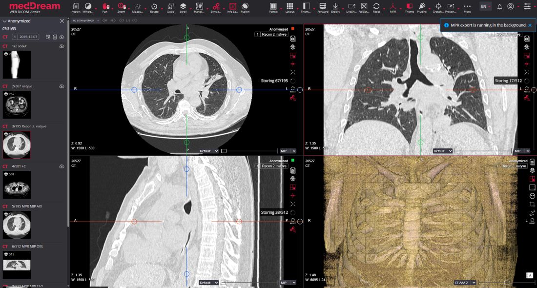 MedDream Dicom Viewer MPR Save As New Series